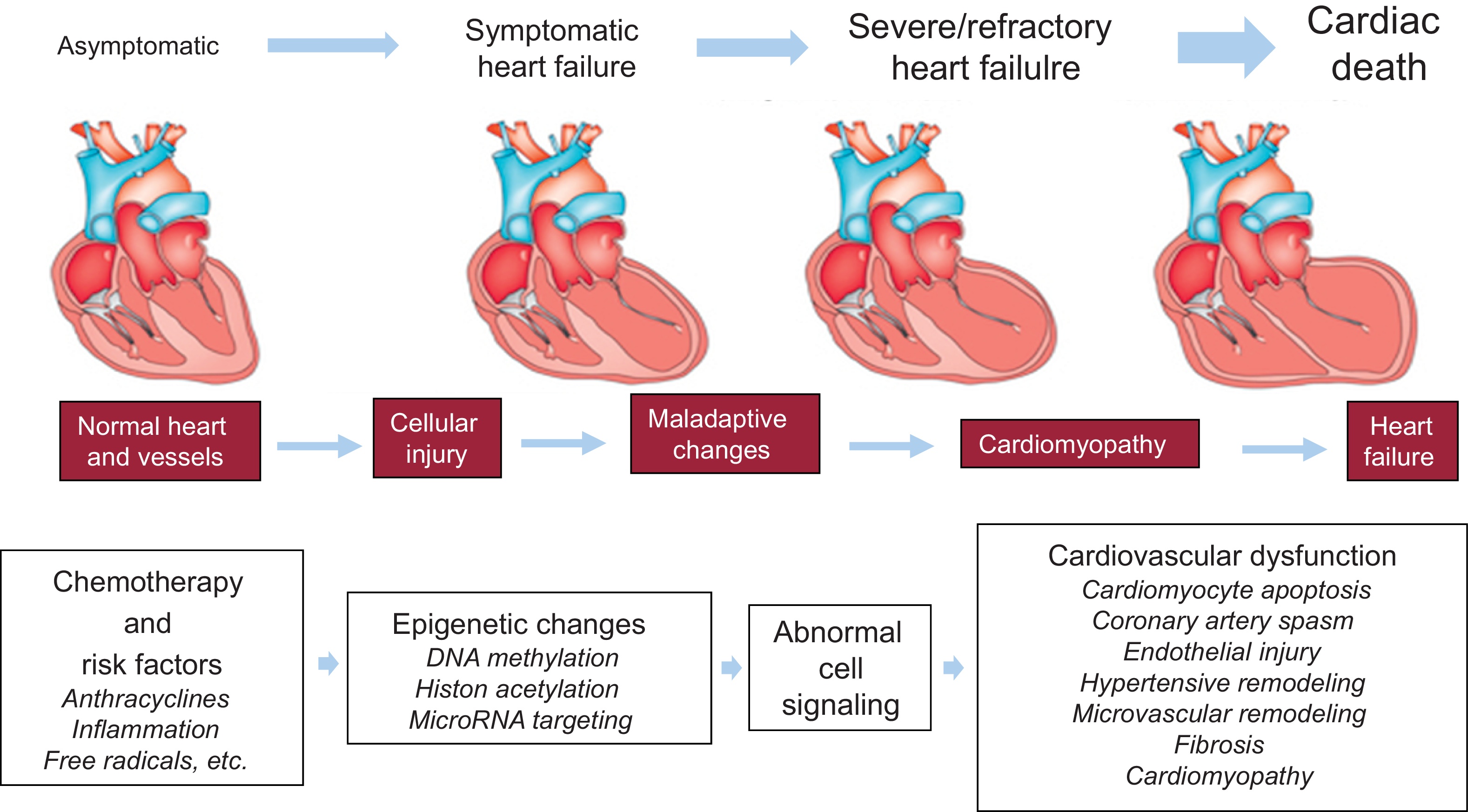 Suy tim - chặng đường cuối nhọc nhằn của bệnh tim mạch
