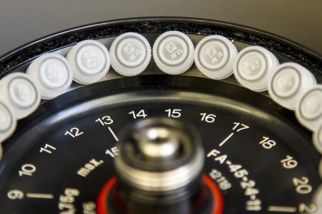 Huyết áp tâm thu là gì?