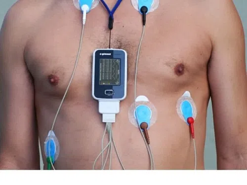 Đo điện tim holter 24h giúp chẩn đoán bệnh mạch vành