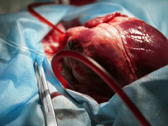 Nhịp tim đập nhanh thất thường có thể là tín hiệu cảnh báo có vấn đề từ cơ quan khác /// Shutterstock