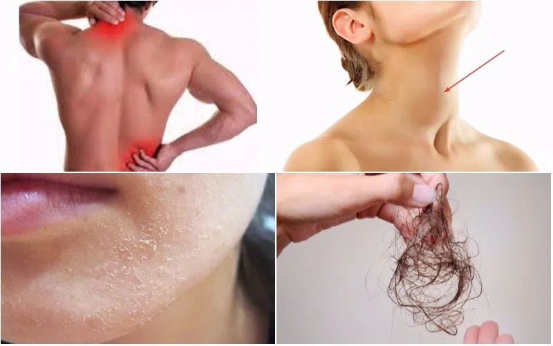 Các triệu chứng của bệnh cường giáp