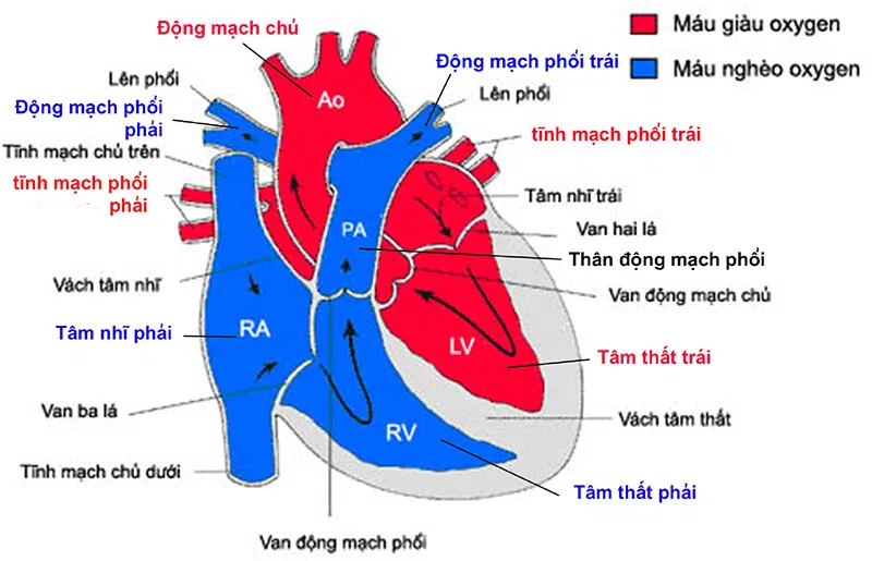 Tim bẩm sinh là gì?