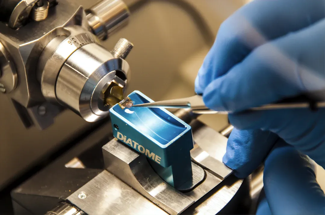 Tại sao mức đường huyết cao vào sáng sớm?